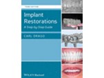 Implant Restorations: A Step-by-Step Guide