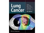 Lung Cancer 4e